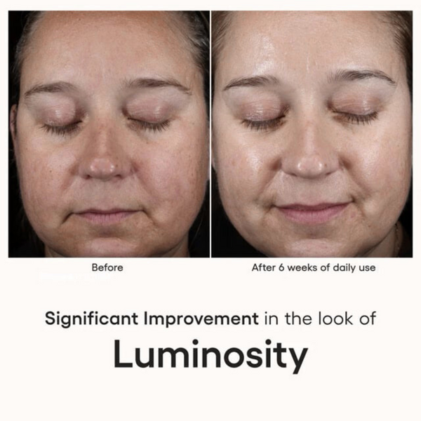 Exosome Intense Serum — Derm to Door