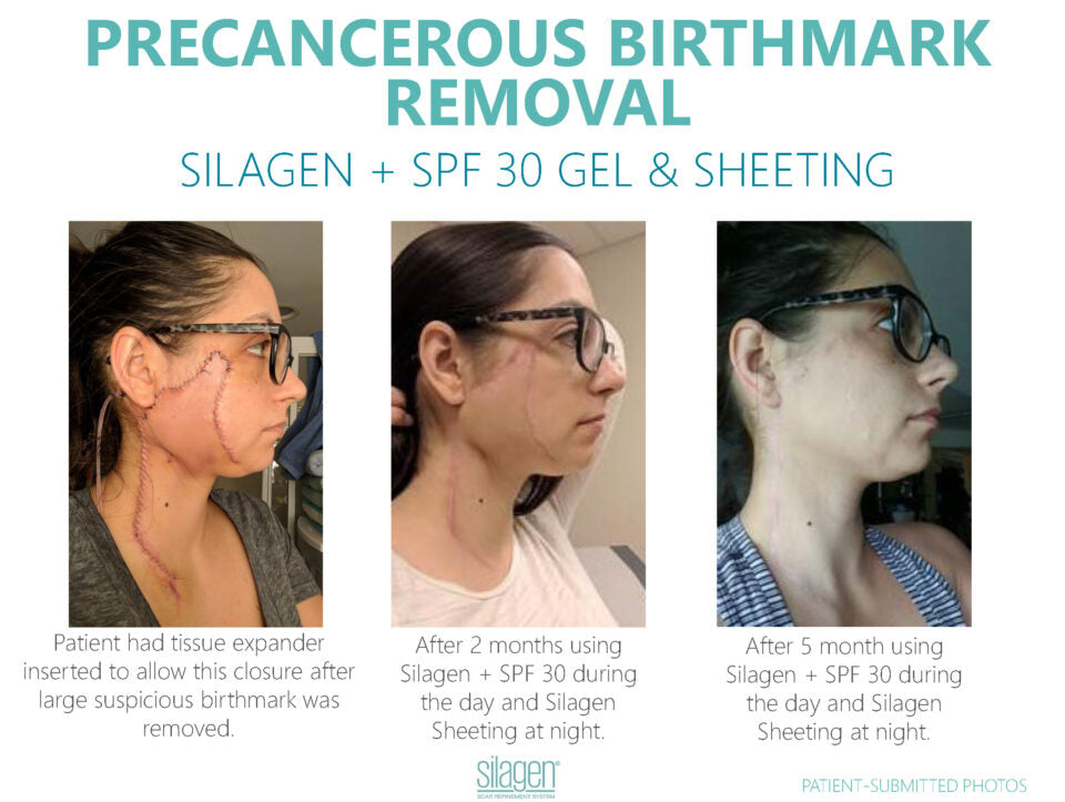 Silagen Silicone Scar Gel SPF 30 (15g)