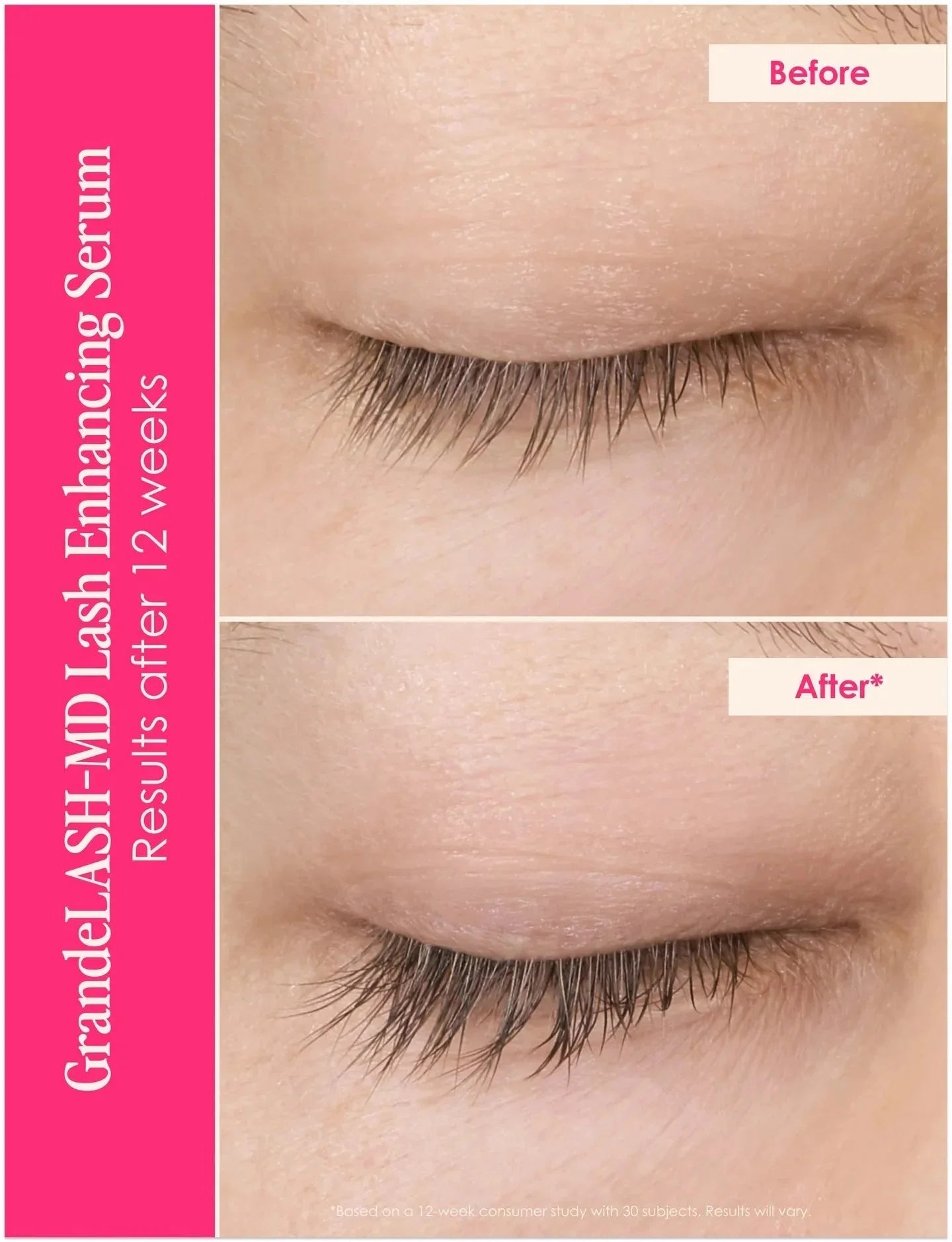 GrandeLASH-MD -  Lash Enhancing Serum