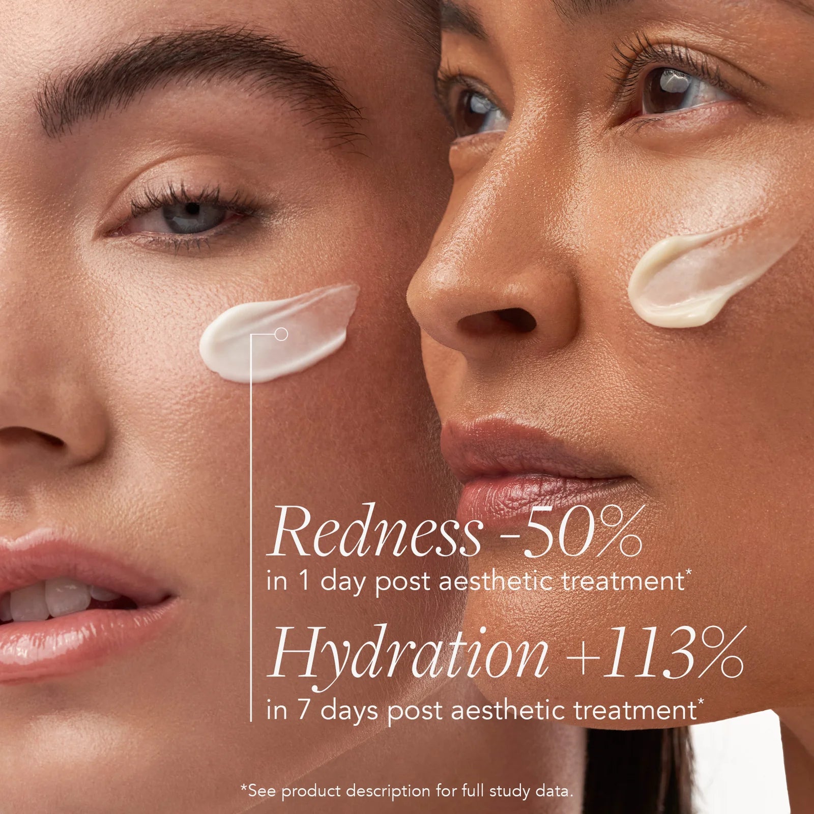 Image Post-Treatment Essentials Kit