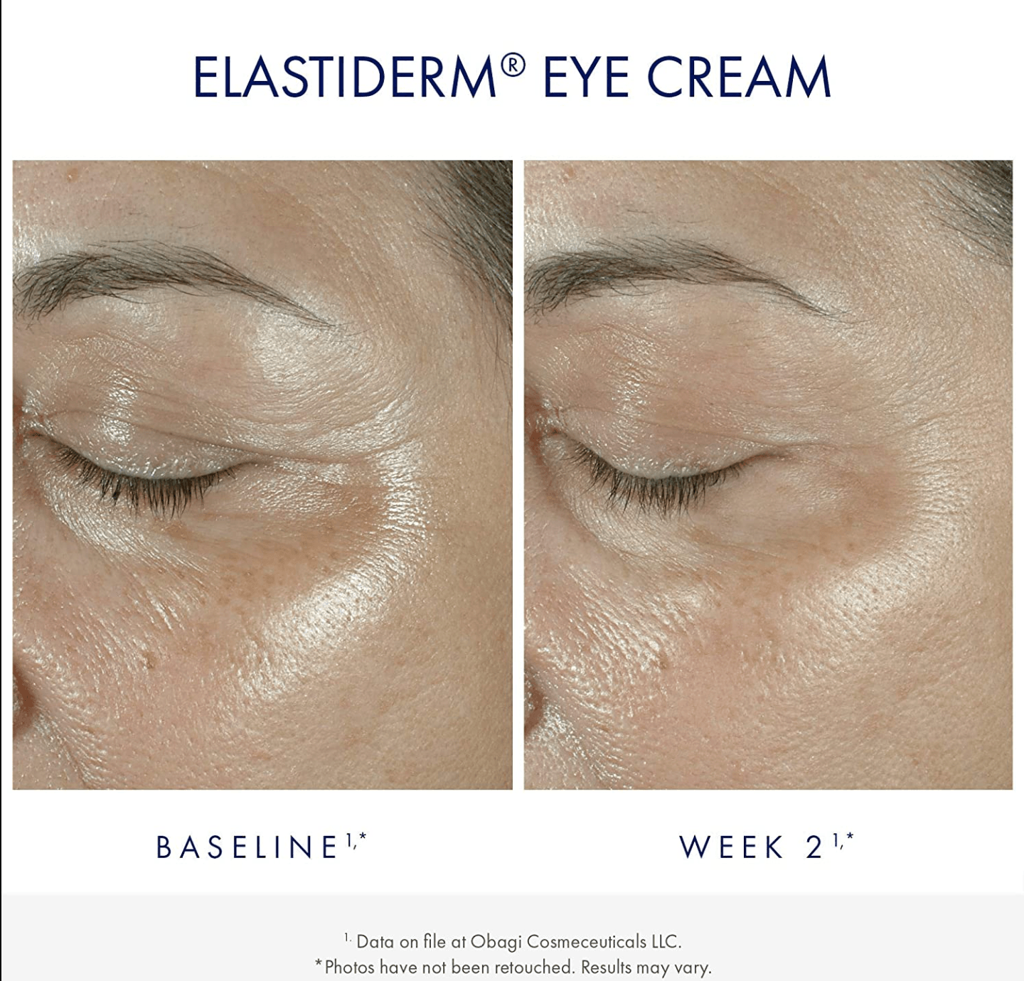Obagi ElastiDerm Eye Cream