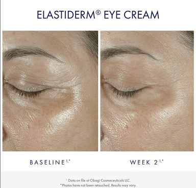 Obagi elastiderm eye cream deals