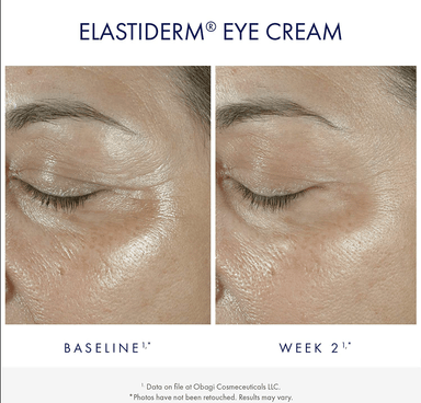 Obagi ElastiDerm Eye Cream